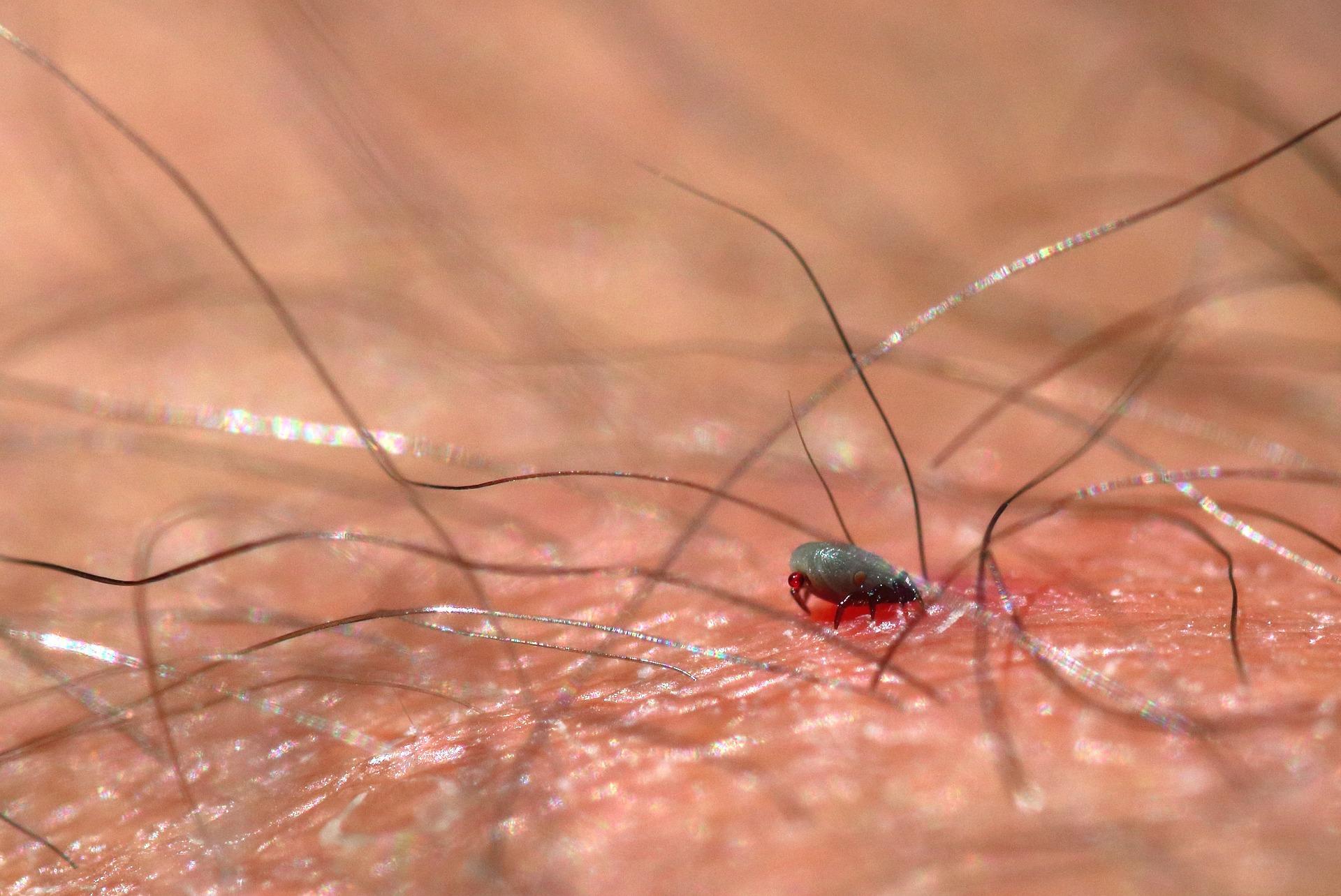 If a tick bites you, remove the pest immediately. 
